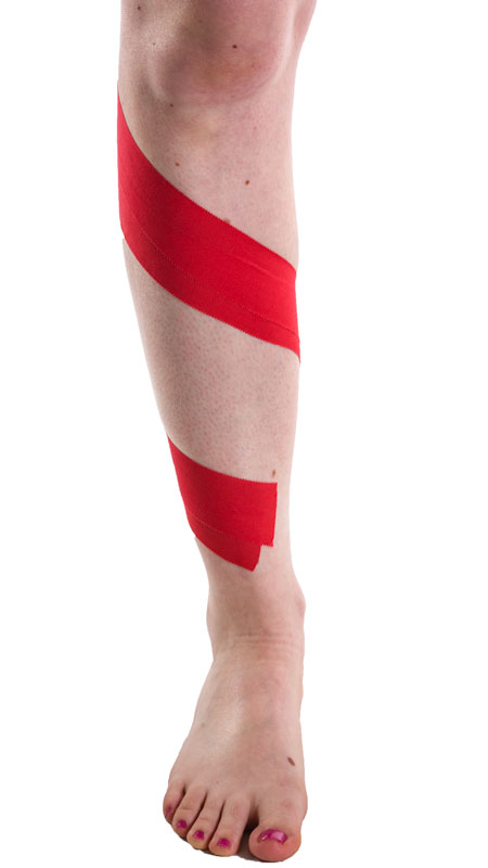 Ongekend Taping for Shin Splints | Physical Sports First Aid Blog KG-42