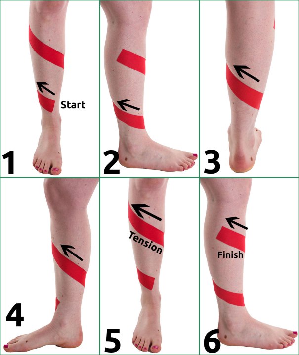 Shin Splint Taping Step by Step